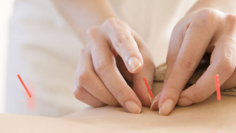 Embracing your Fertility Acupuncture